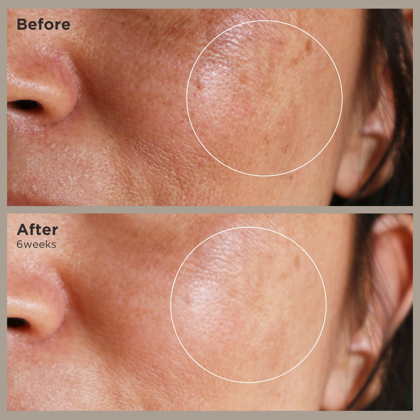 Nonapeptide-1 Serum ARWIN BIOCHEM