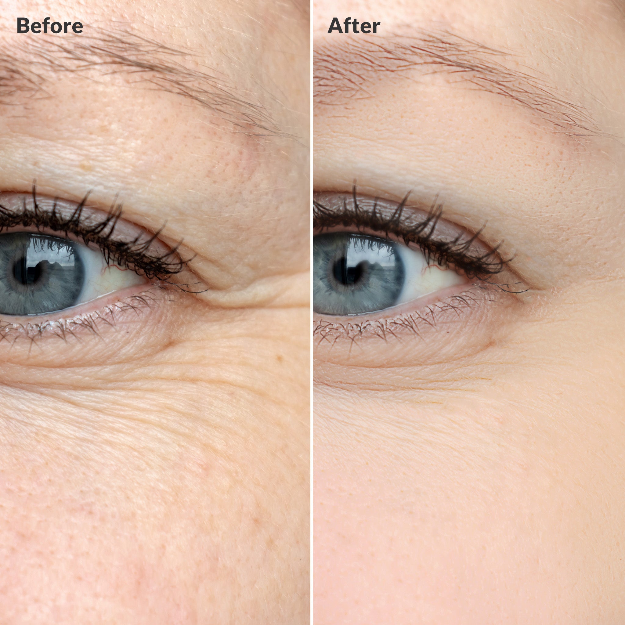 Golden Placenta Ultra Eye Cream ARWIN BIOCHEM