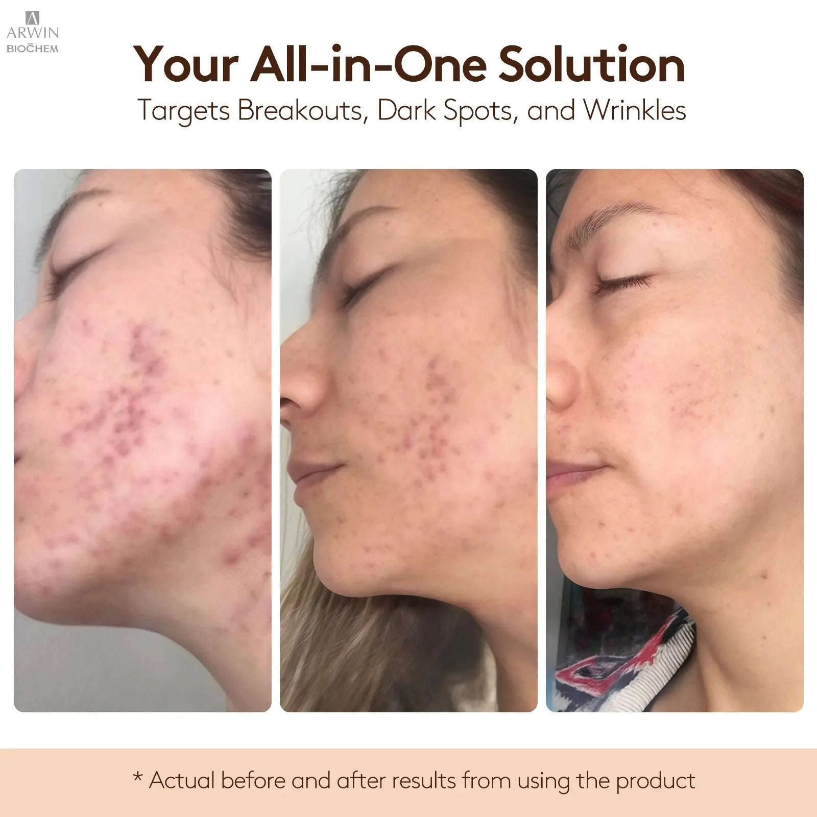 DL-Mandelic Acid - Facial Skin Renewal Ampoule Serum My Store