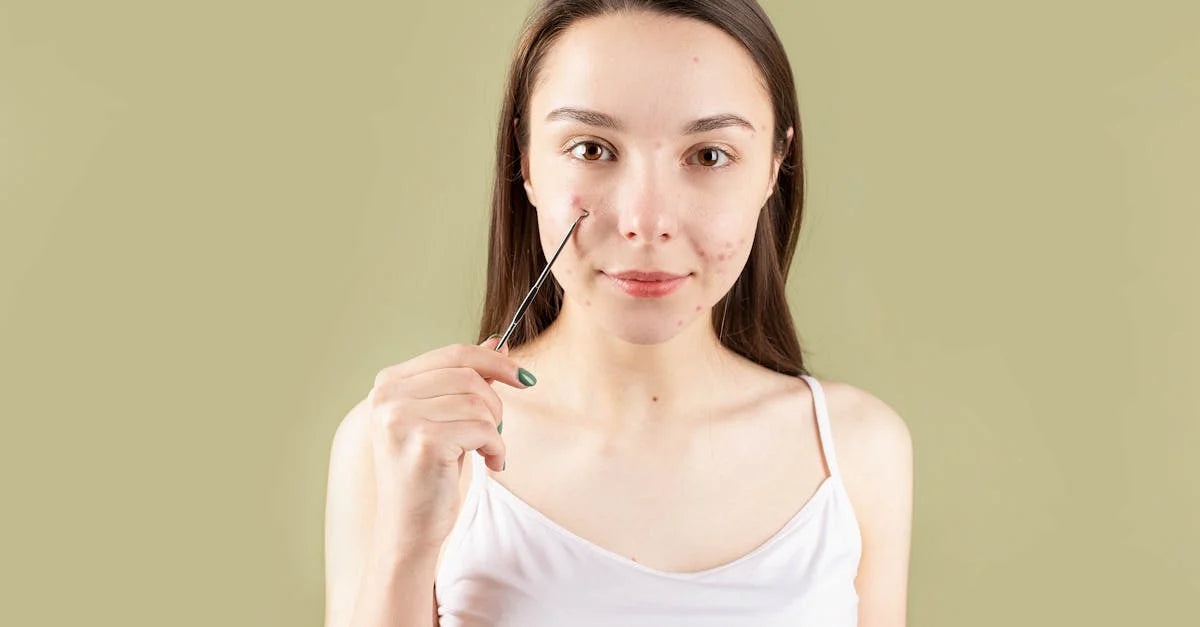 Top 6 Tips for Treating Hormonal Acne
