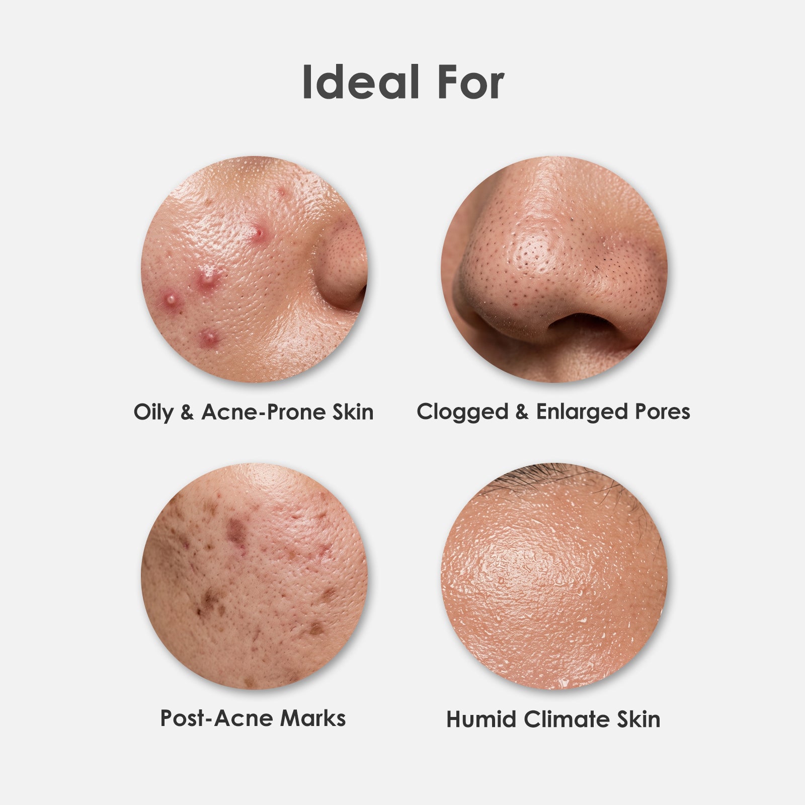 Clear Skin Control Set (Neem Gel + Powder Wash + Nonapeptide) ARWIN BIOCHEM