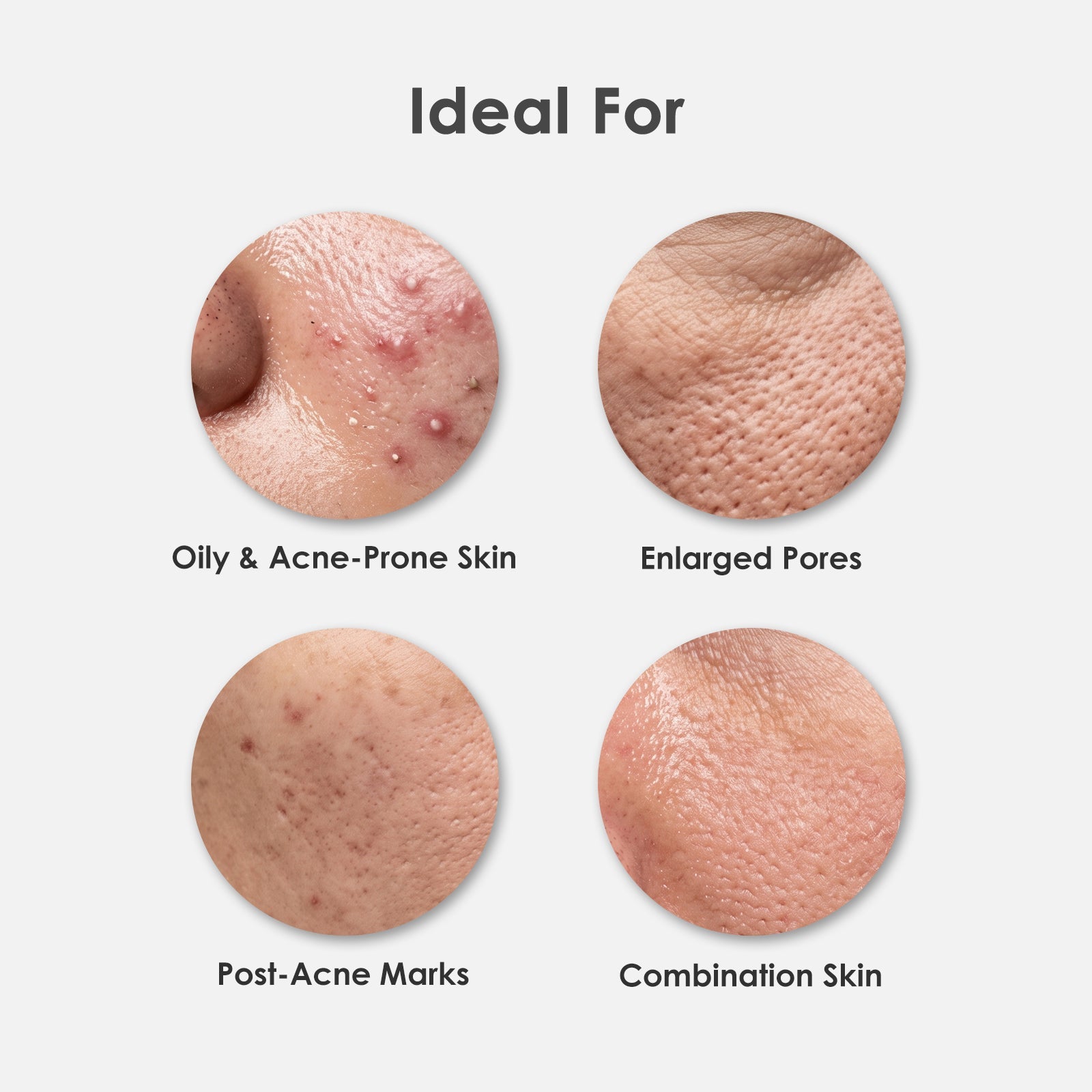Acne-Control Evening Routine( Nonapeptide + Glycoprotein + Neem AC Gel ) ARWIN BIOCHEM