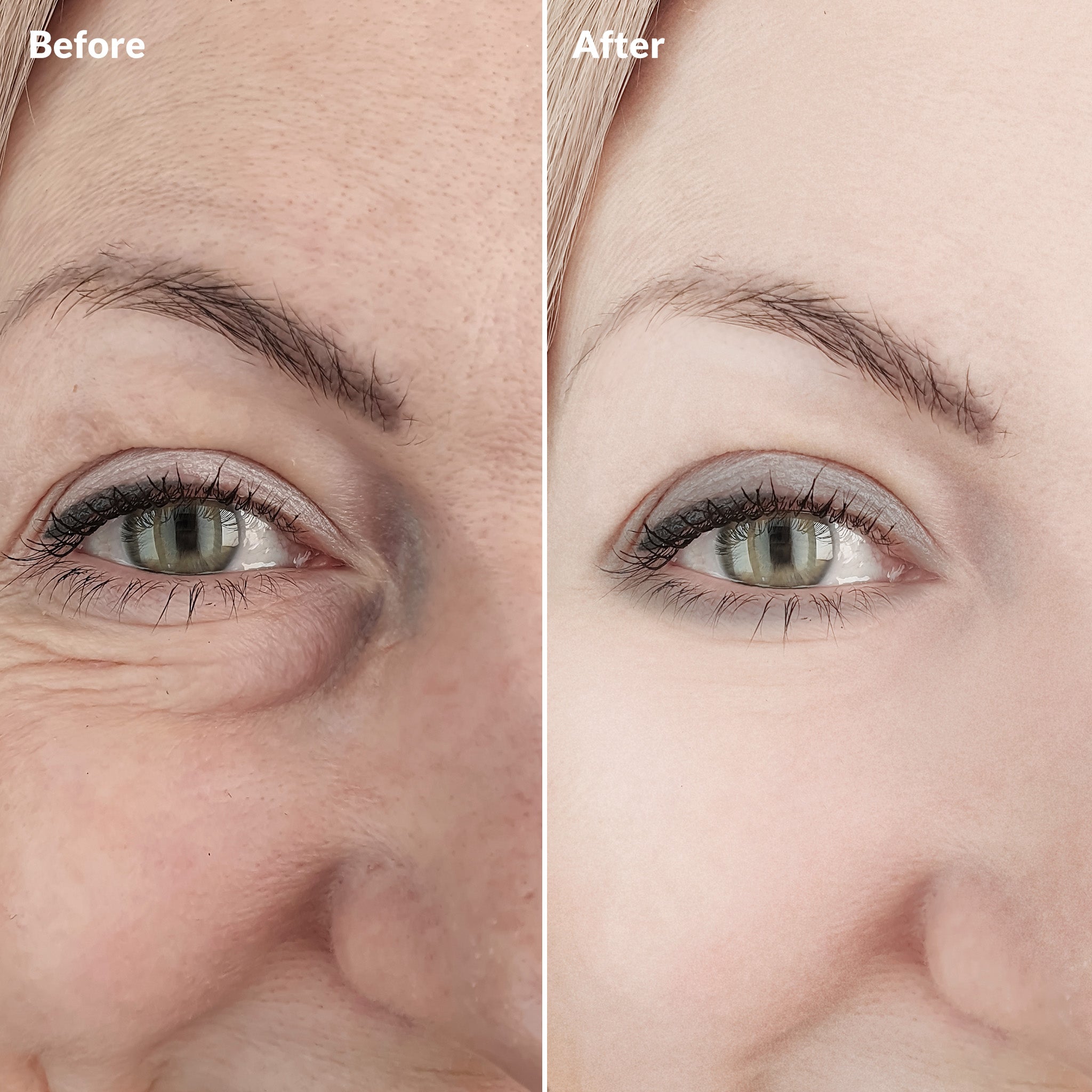 8-Oligopeptide Anti-Aging Serum ARWIN BIOCHEM